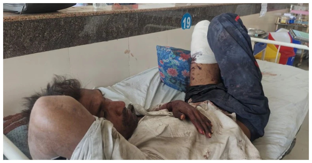 ১২ ঘণ্টা পর পা উদ্ধার, পুলিশের অবহেলায় চিরতরে পঙ্গু শ্রমিক